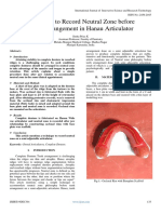 Technique To Record Neutral Zone Before Teeth Arrangement in Hanau Articulator