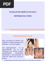 Hiperqueratosis