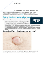 Todo Sobre La Hernia