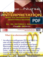 Basic Ecg Interpretation and Arrhythmia Recognition By: Ma. Victoria E. Martinez Er - RN