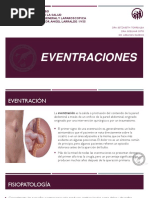 EVENTRACIONES