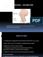 Endotracheal Intubation