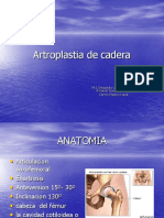 Artroplastia de Cadera 1