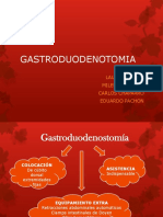 Gastroduodenostomía