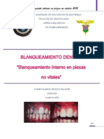 Blanqueamiento Interno