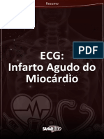 Resumo Infarto Agudo Do Miocardio