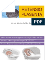 Retensio Plasenta