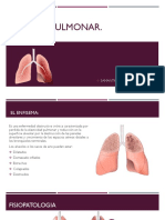 Enfisema Pulmonar EXPO