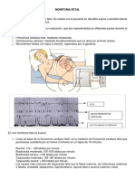 Monitoria Fetal