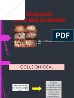 Etiologia de La Maloclusión Cii 2019 2020