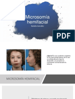 Sindrome Microsomía Hemifacial