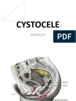 Cystocele: Michelo F