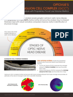 Optovue's Ganglion Cell Complex