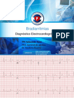 Clase de Bradiarriatmias PDF