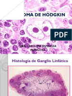 3 Linfoma de Hodgkin