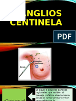 Ganglios Centinela