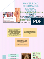 Insuficiencia Placentaria