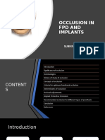 Occlusion in FPD and IMPLANTS