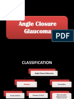 Angle Closure Glaucoma