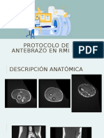 Protocolo de Antebrazo en Rmi