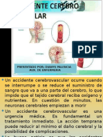 Accidente Cerebrovascular