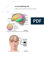 EEG or Electroencephalogram