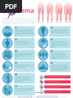 Lipedema Infografico