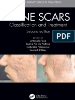 Acne Scars Classification and Treatment