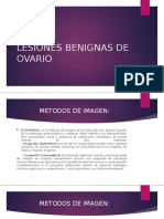 Lesiones Benignas de Ovario