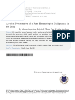 Atypical Presentation of A Rare Hematological Malignancy in The Lung