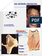 Traumatismealveolodentaires DR Berthet