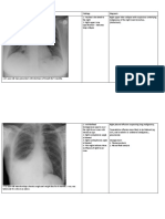 Radiology Notes For OSCE