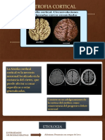 Atrofia Cortical