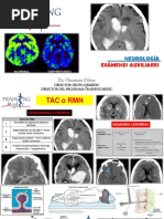 Exámenes Auxiliares: Neurología