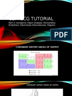 CLIX ECG Tutorial Part 3 Ischaemia Etc