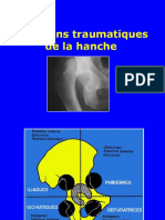 05 - Luxations de La Hanche