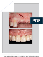 Creatingpapilladentalimplantxp PDF