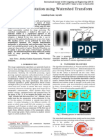 Image Segmentation Using Watershed Transform: Amandeep Kaur, Aayushi