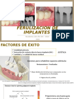 Ferulización de Implantes