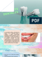 Implantes Dentales