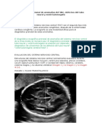 Diagnóstico Prenatal de Anomalías Del SNC