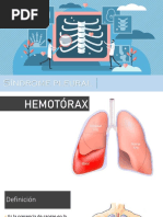 Sindrome Pleural