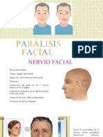 Parálisis Facial