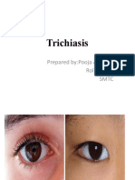 Trichiasis: Prepared By:pooja Adhikari Roll No.: 27 SMTC