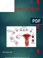 Embarazo Ectopico (13 Ago 2018) 2