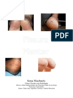 Fissura Plantar