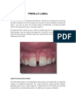 Frenillo Labial