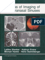 Anatomi Sinus Paranasalis PDF