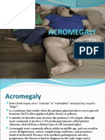 Acromegaly