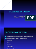 Malpresentation: &malposition